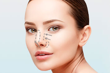 rinomodelacion clinica renacer